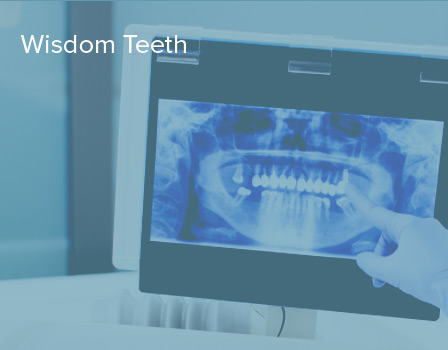 Wisdom Teeth Extractions